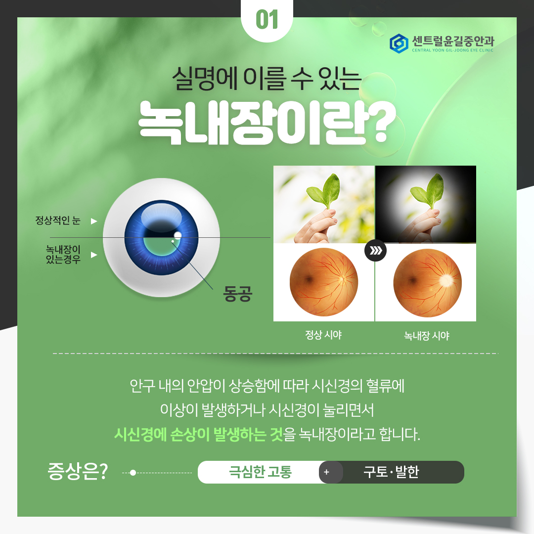 광주안과의원 이미지