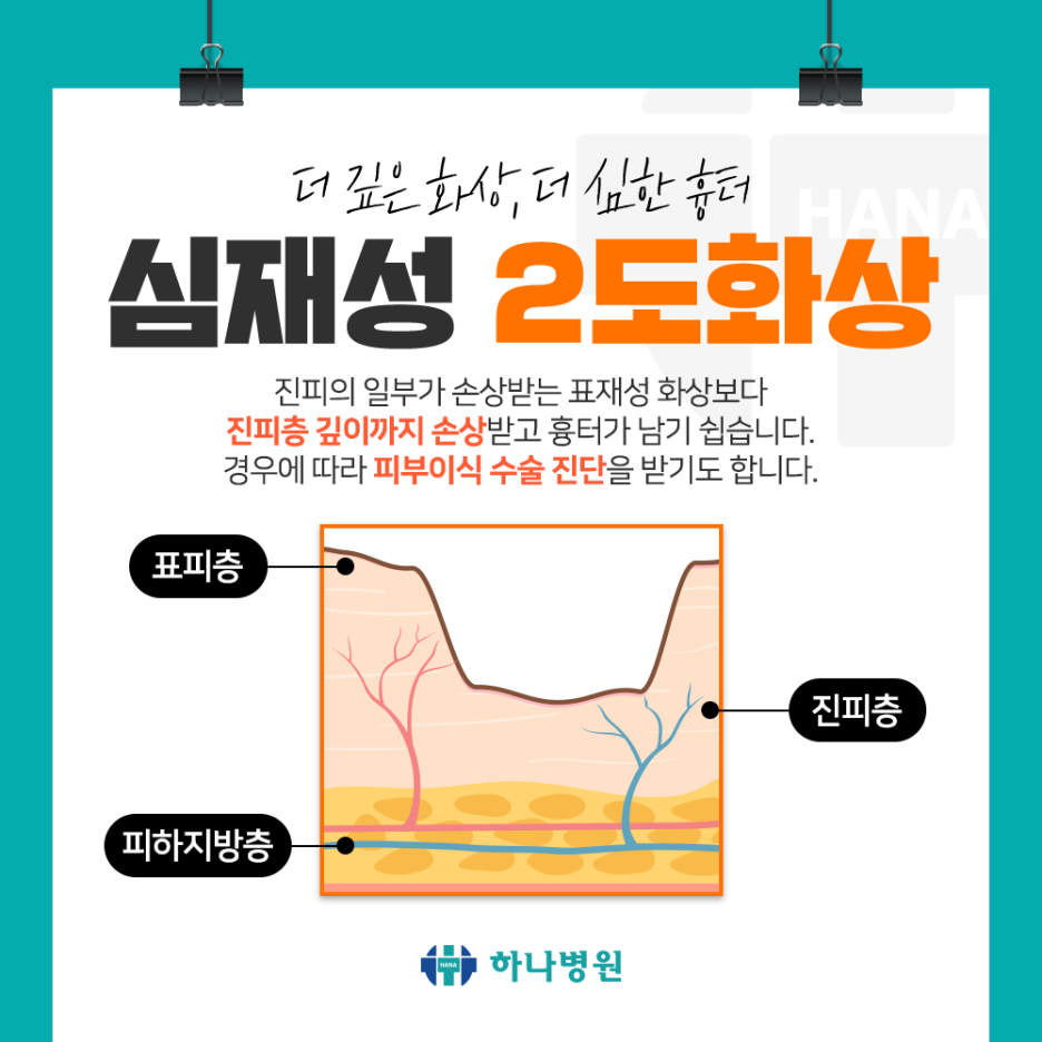 2도헤어 이미지
