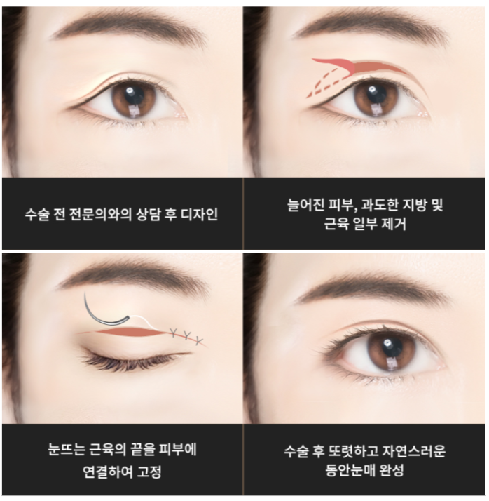 라이블리성형외과의원 이미지
