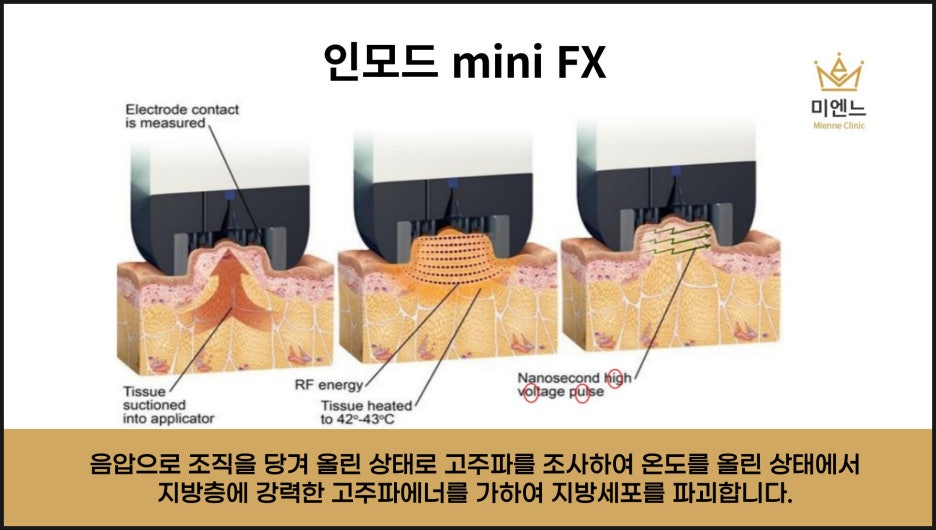 미엔느의원 이미지