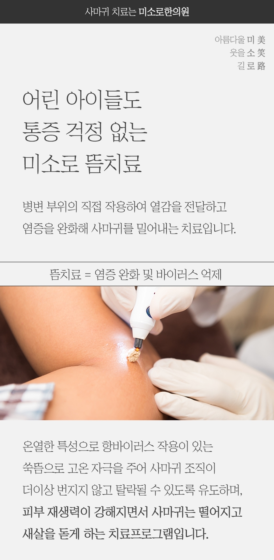 광명쑥뜸 이미지