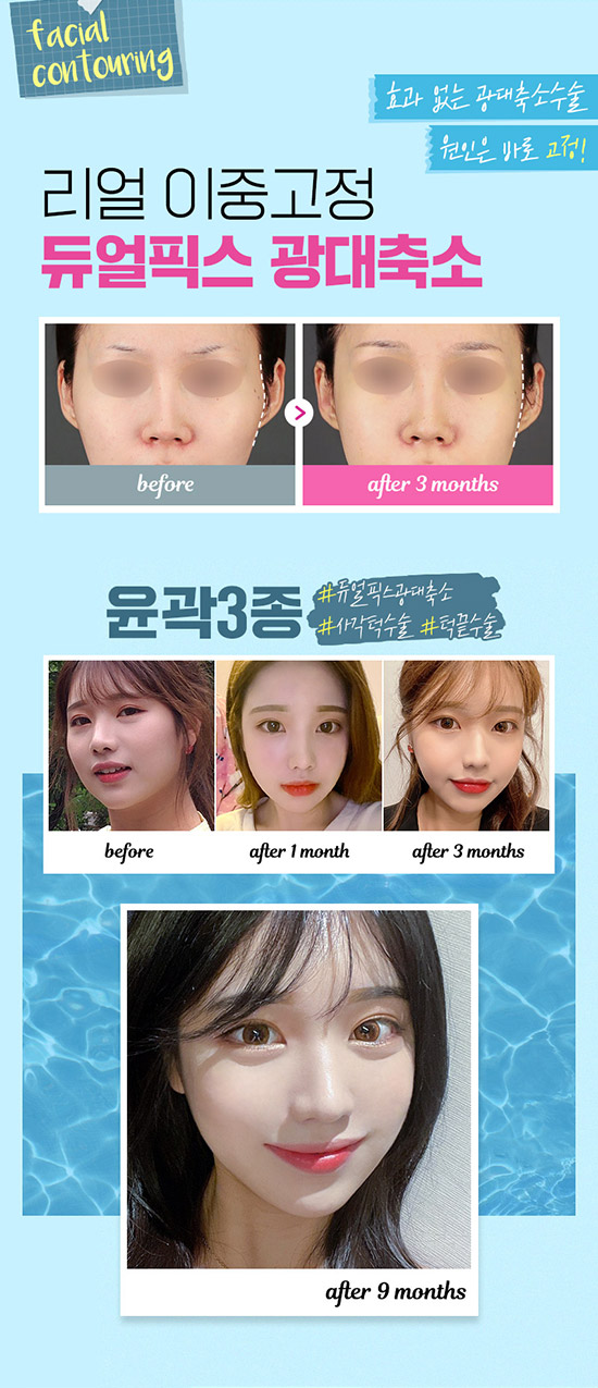 한코티에스 이미지