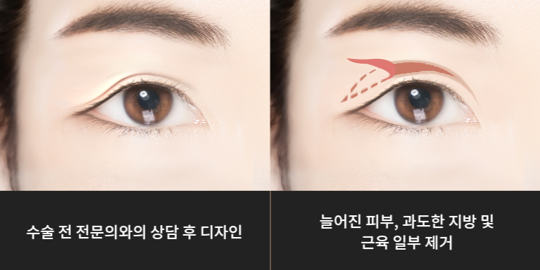 라이블리성형외과의원 이미지