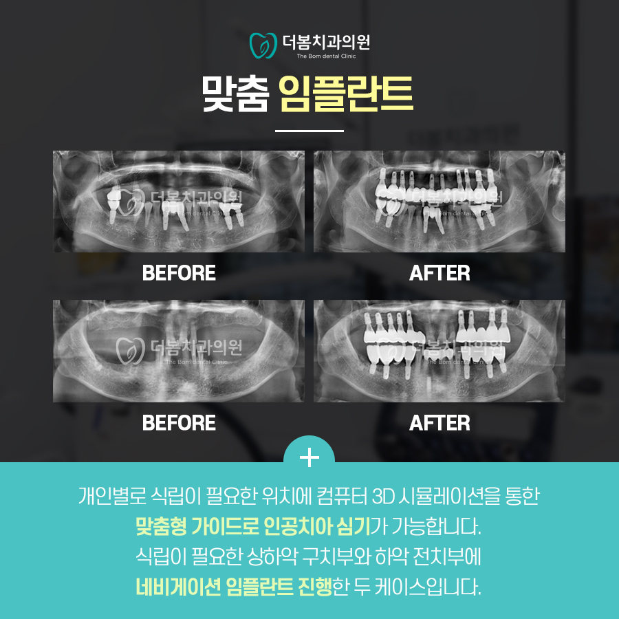 더봄치과 이미지