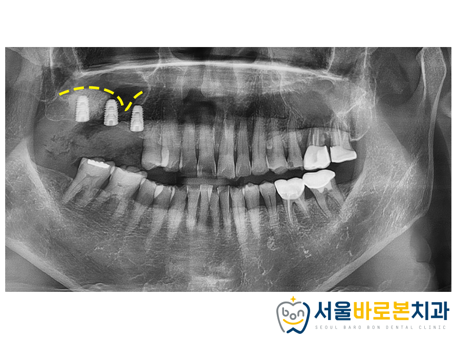 김의치과 이미지