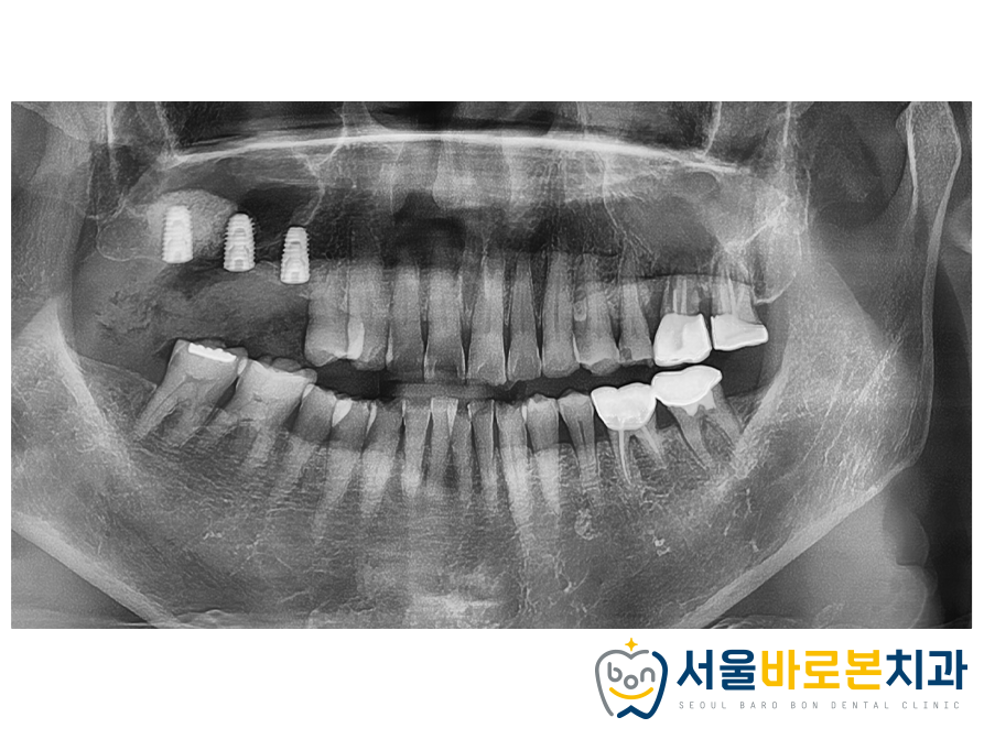 김의치과 이미지