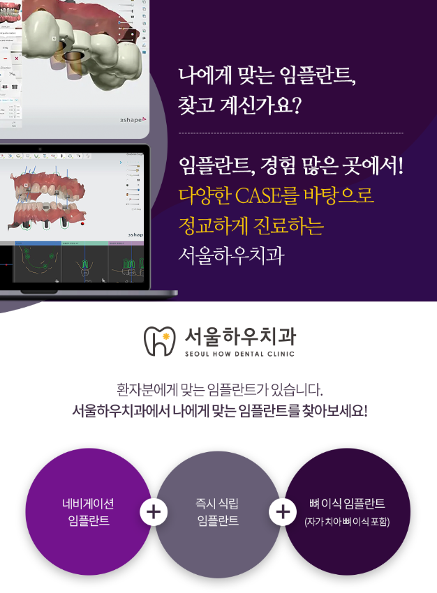 서울하우치과 이미지
