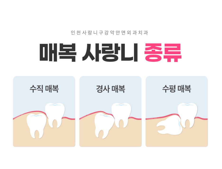 인천사랑니구강악안면외과치과의원 이미지