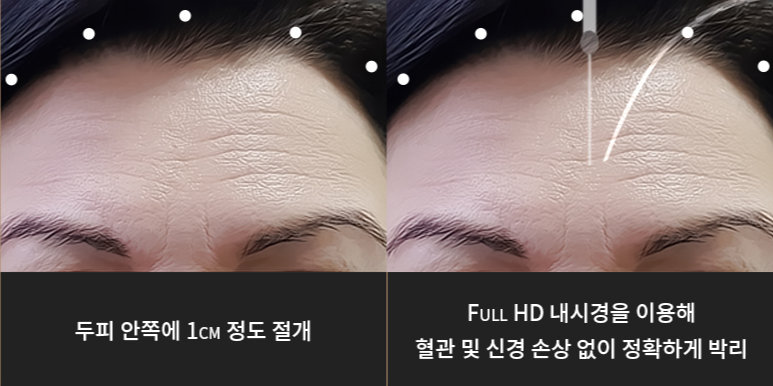 라이블리성형외과의원 이미지