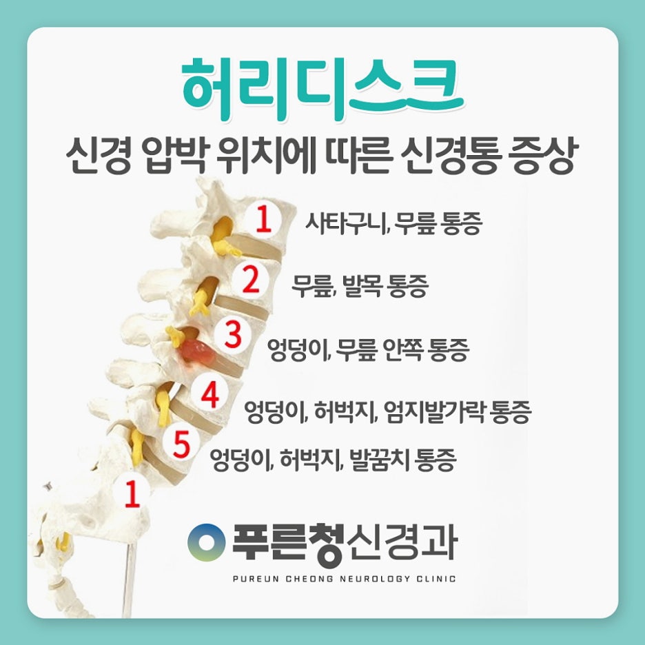 수성신경과 이미지