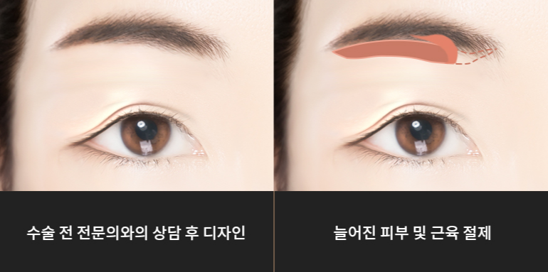 라이블리성형외과의원 이미지