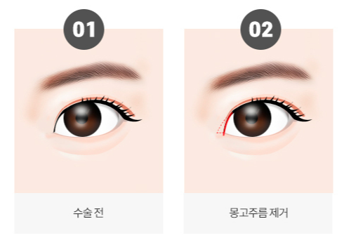 꼼꼼성형외과의원 이미지