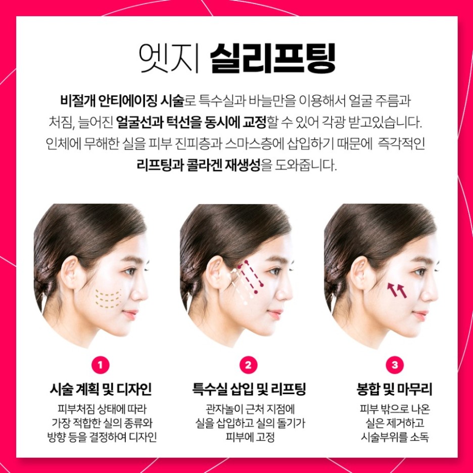 엣지성형외과 이미지