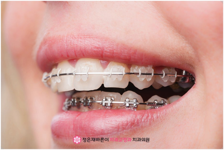 가지런한치과교정과치과의원 이미지