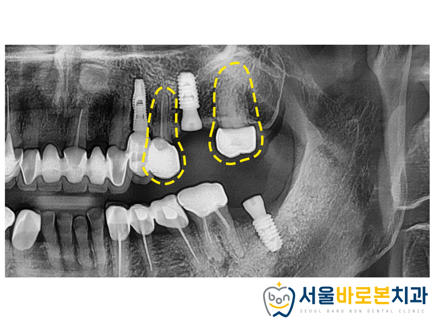 김의치과 이미지