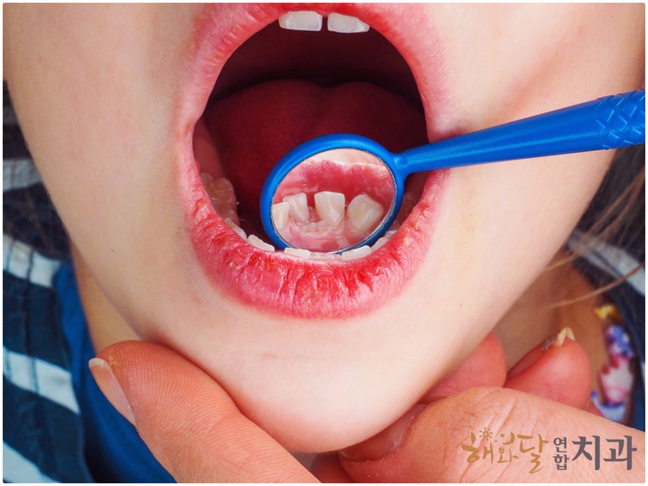 해와달연합치과 이미지