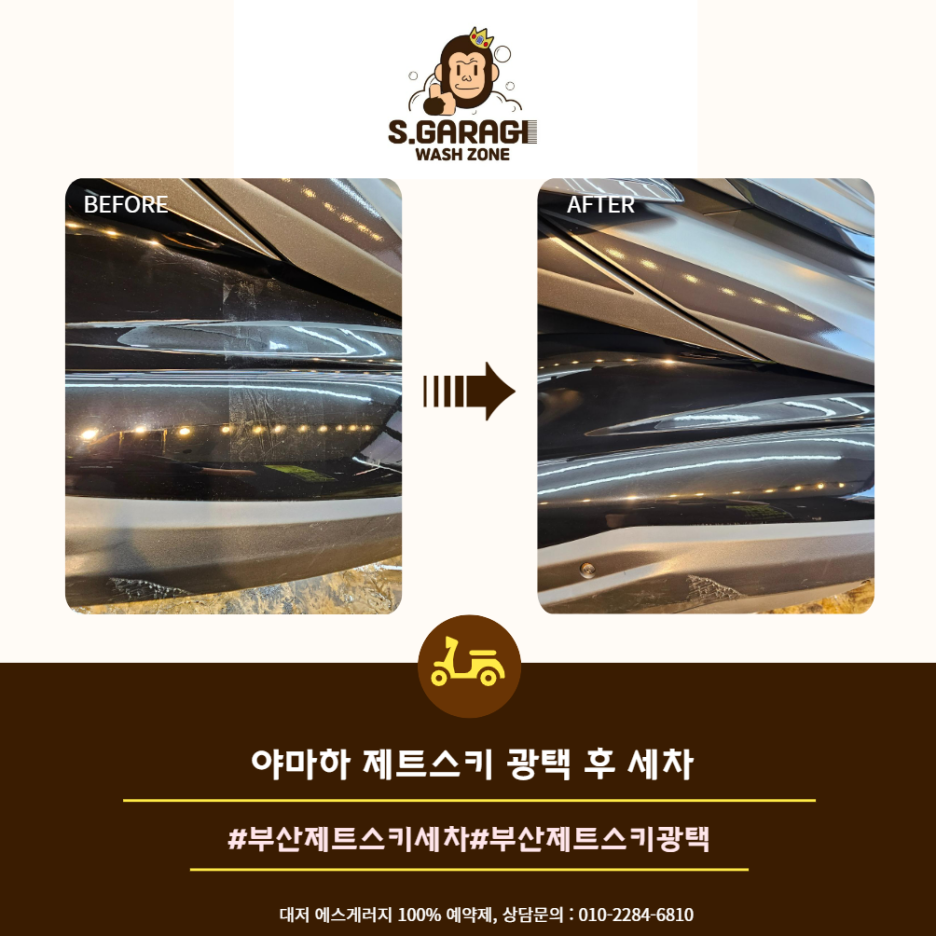 제트게러지 이미지