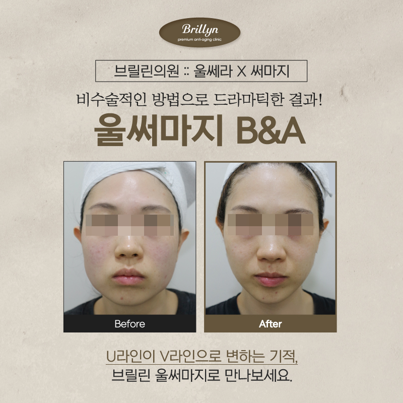 브릴린의원 이미지