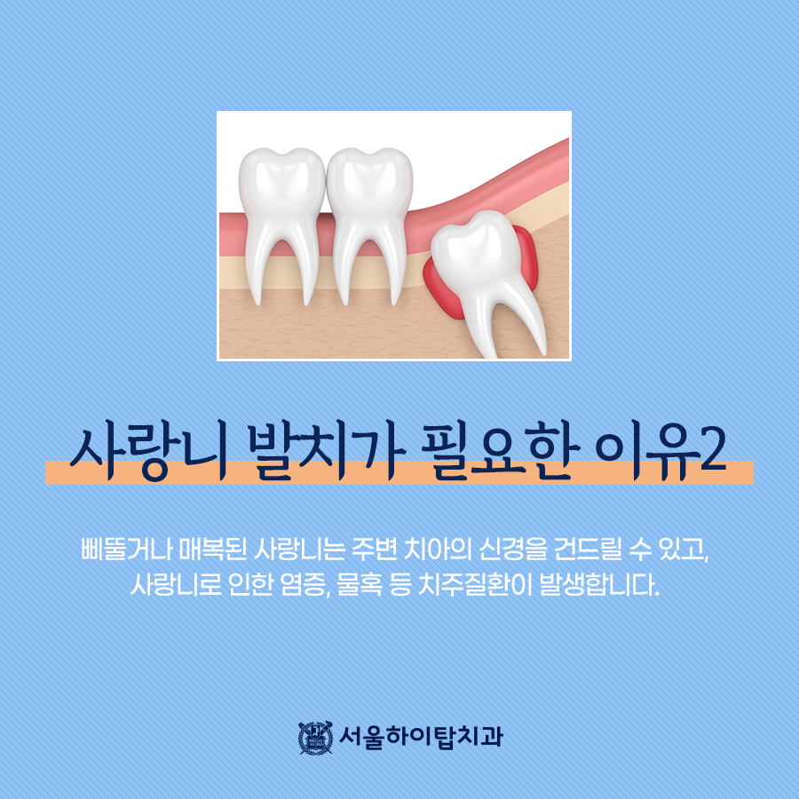 서울턱사랑니치과 이미지