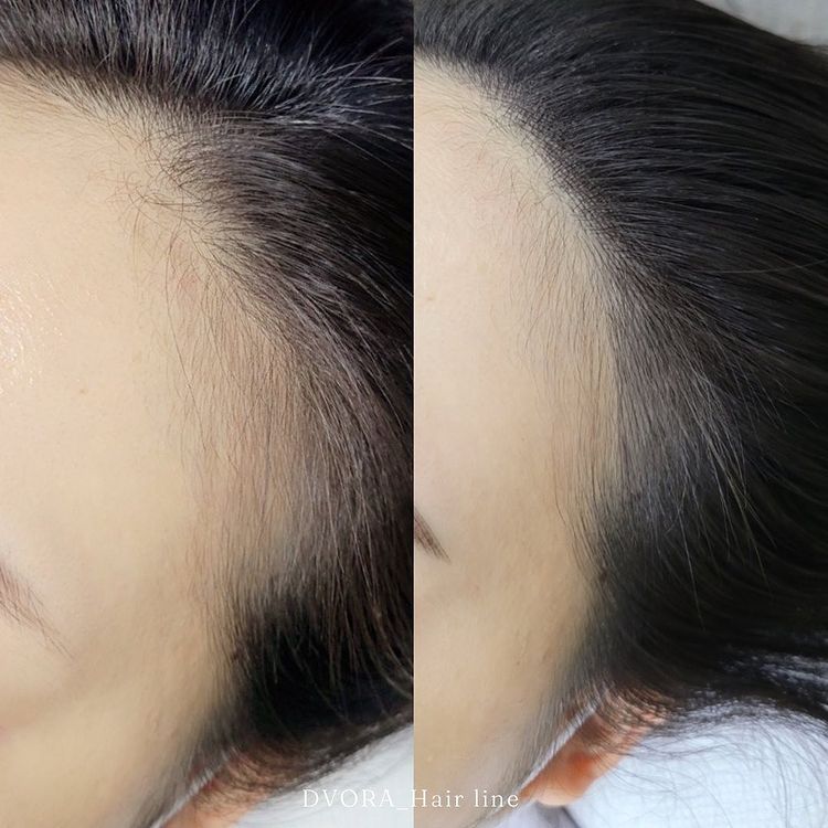 비단라인 이미지