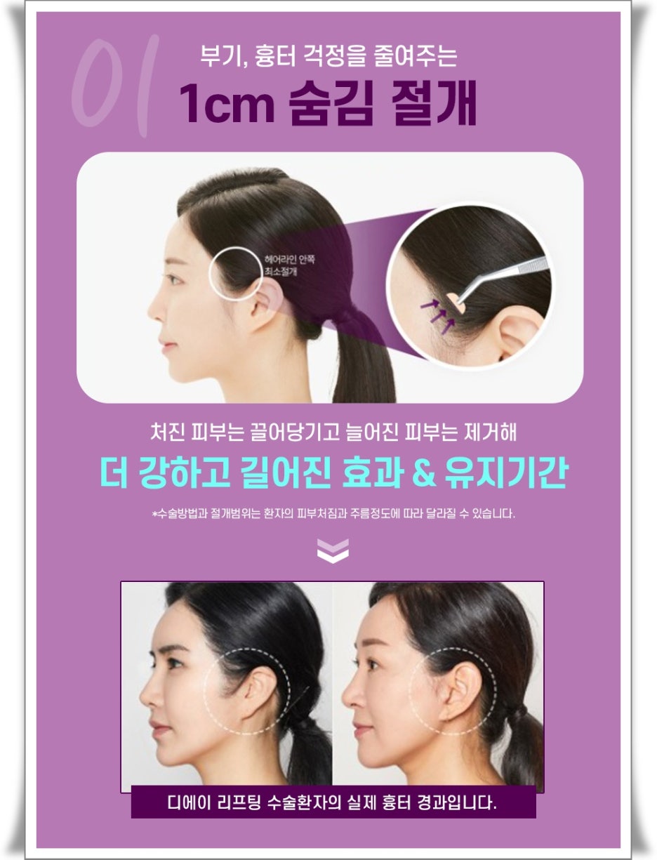 디에이헤어 이미지
