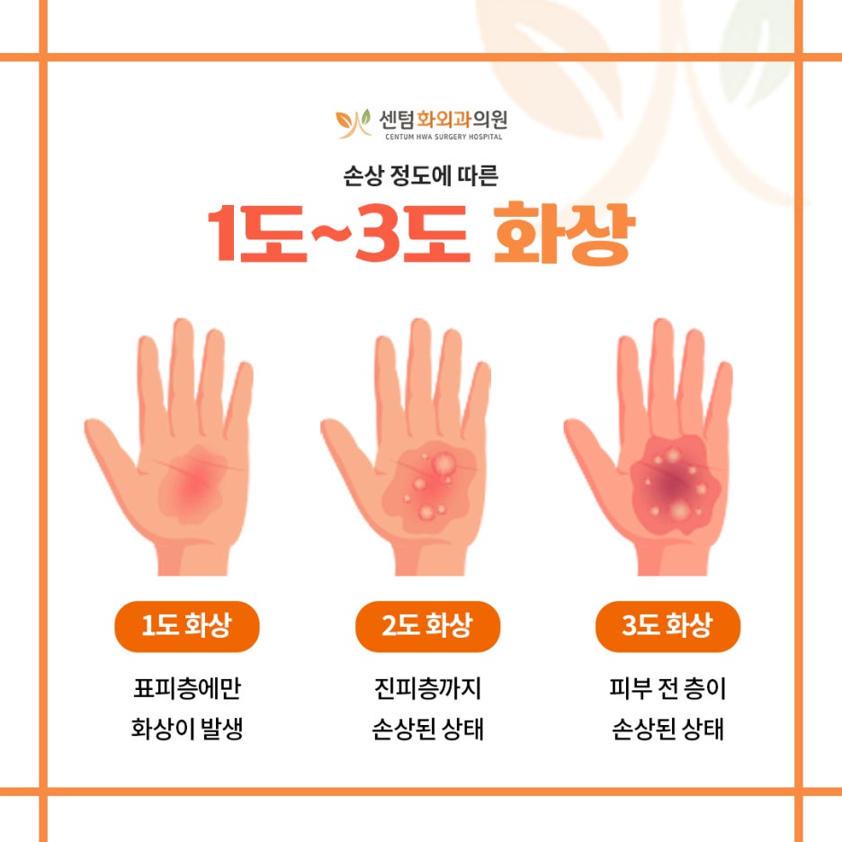 1도, 2도, 3도 화상에 따라 달라지는 치료 방법 : 네이버 블로그