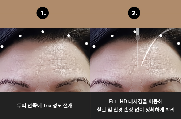 라이블리성형외과의원 이미지