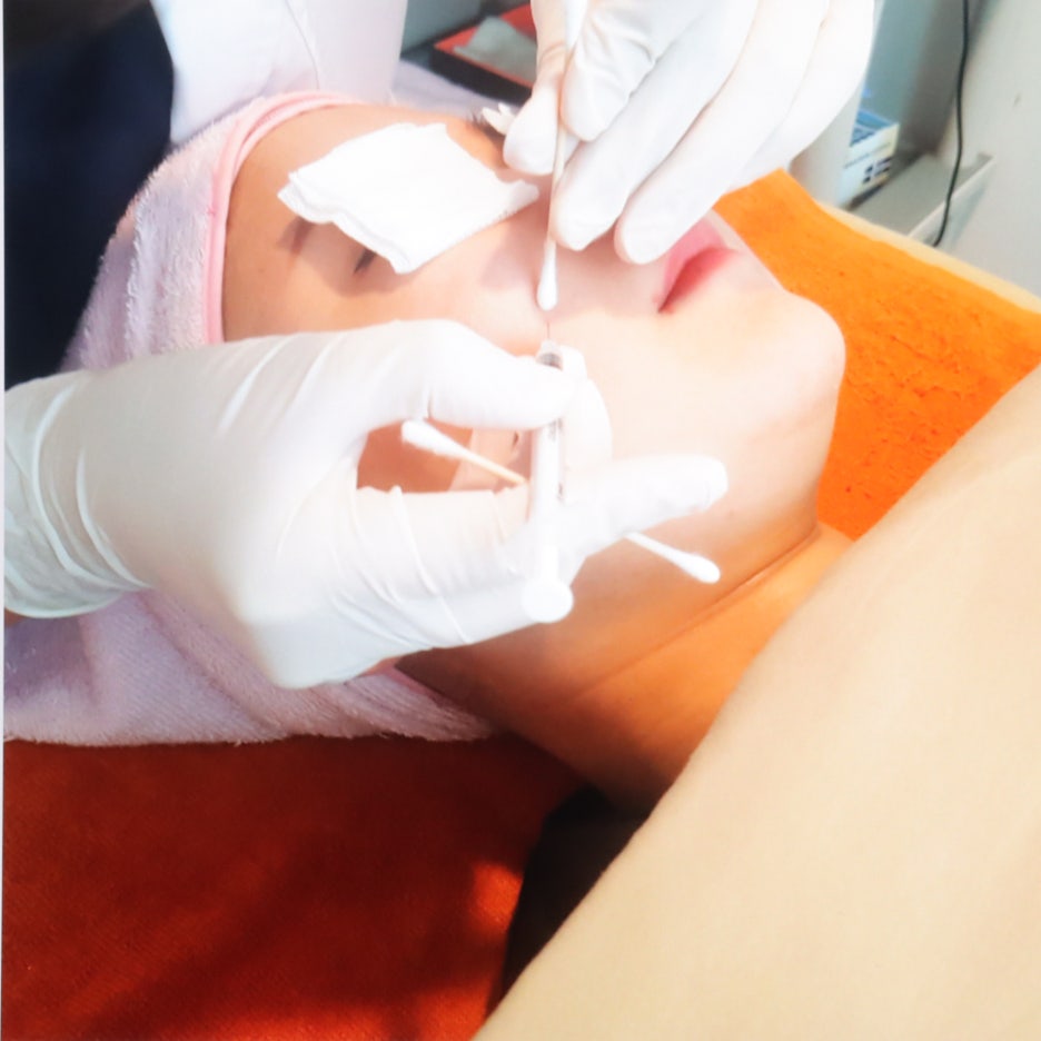 수두피케어 이미지