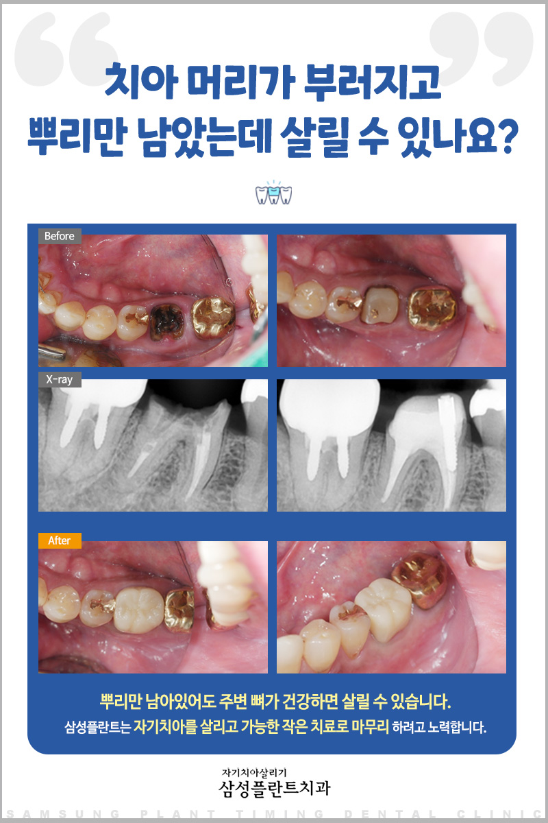 삼성플란트치과의원 이미지
