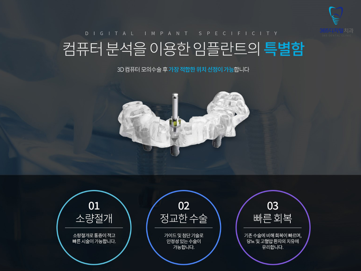 둔산동 전체임플란트 결정 전 흔한 무치악과 틀니 치료 불편감 비교 기준 정리