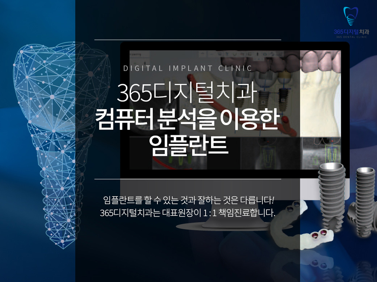 둔산동 전체임플란트 필요성 자연치 수명과 평균수명 차이로 생기는 치아 상실 고민