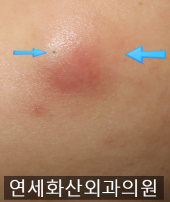 연세화산외과 이미지