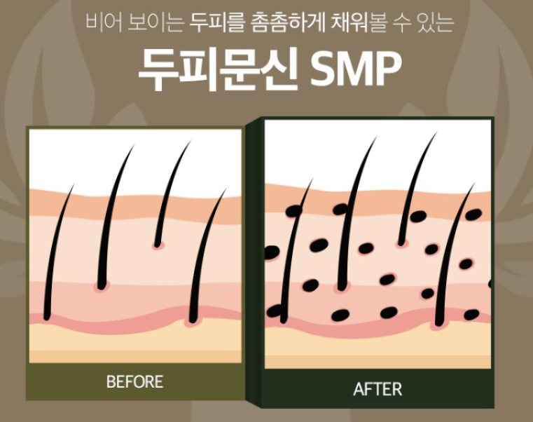인업 이미지