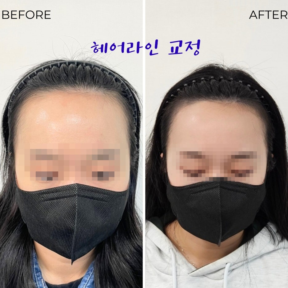 채우림뷰티 이미지
