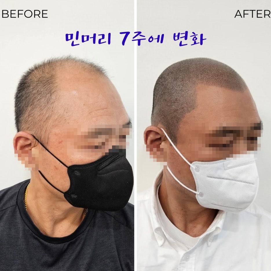 채우림뷰티 이미지