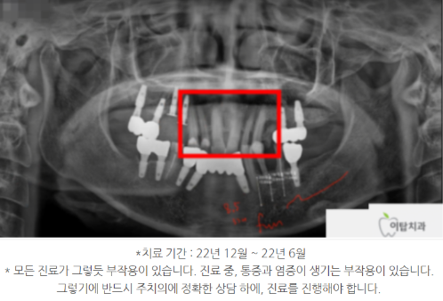 이탑치과 이미지