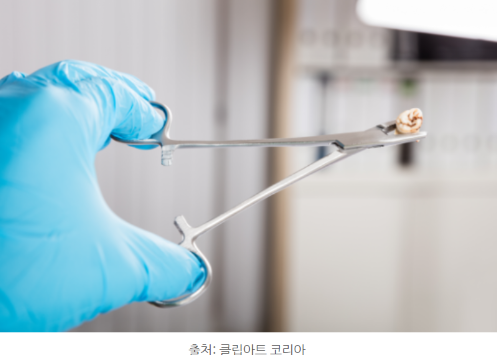 이탑치과 이미지