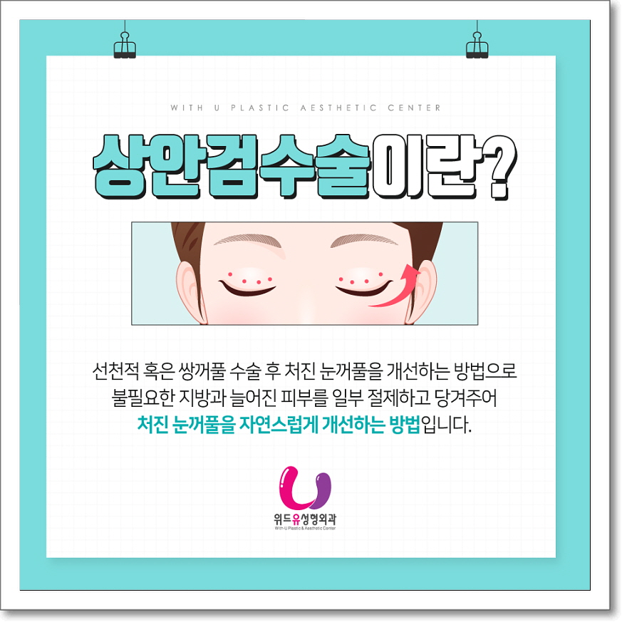 이젠성형외과 이미지