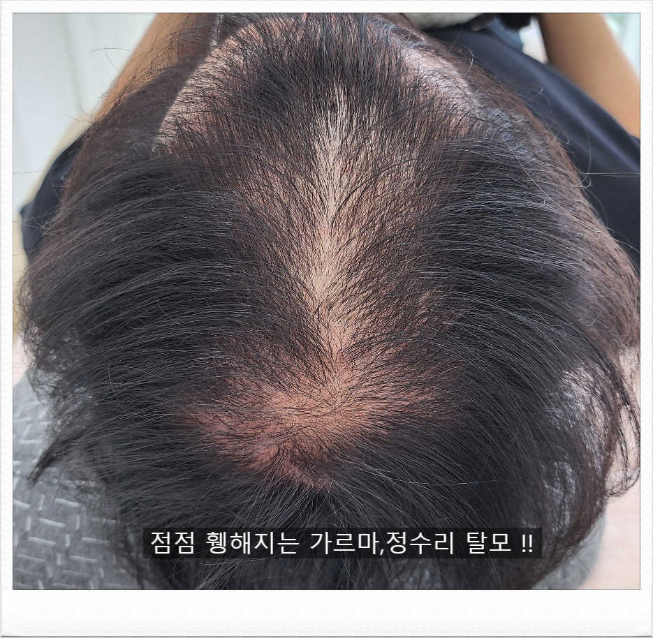인업 이미지