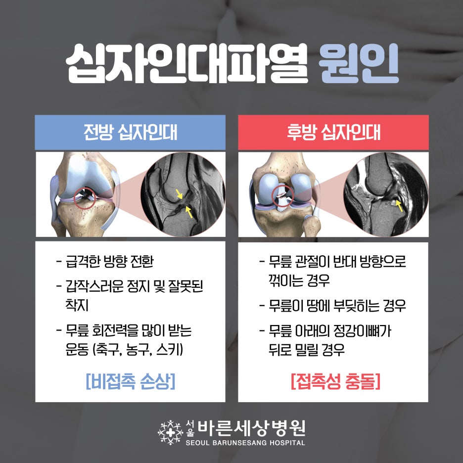 우리 몸의 뼈와 뼈를 연결해주는 인대! 발목인대 파열과 십자인대 파열의 증상 및 치료법 ! : 네이버 블로그