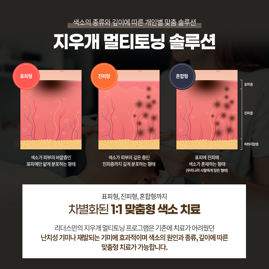 광장피부과 이미지