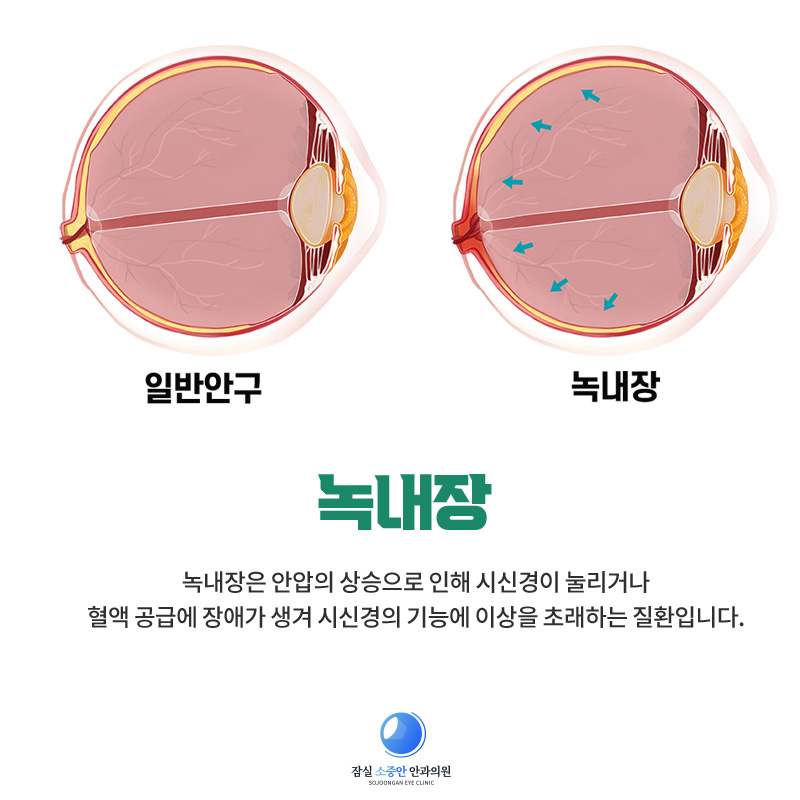 잠실소중안안과의원 이미지