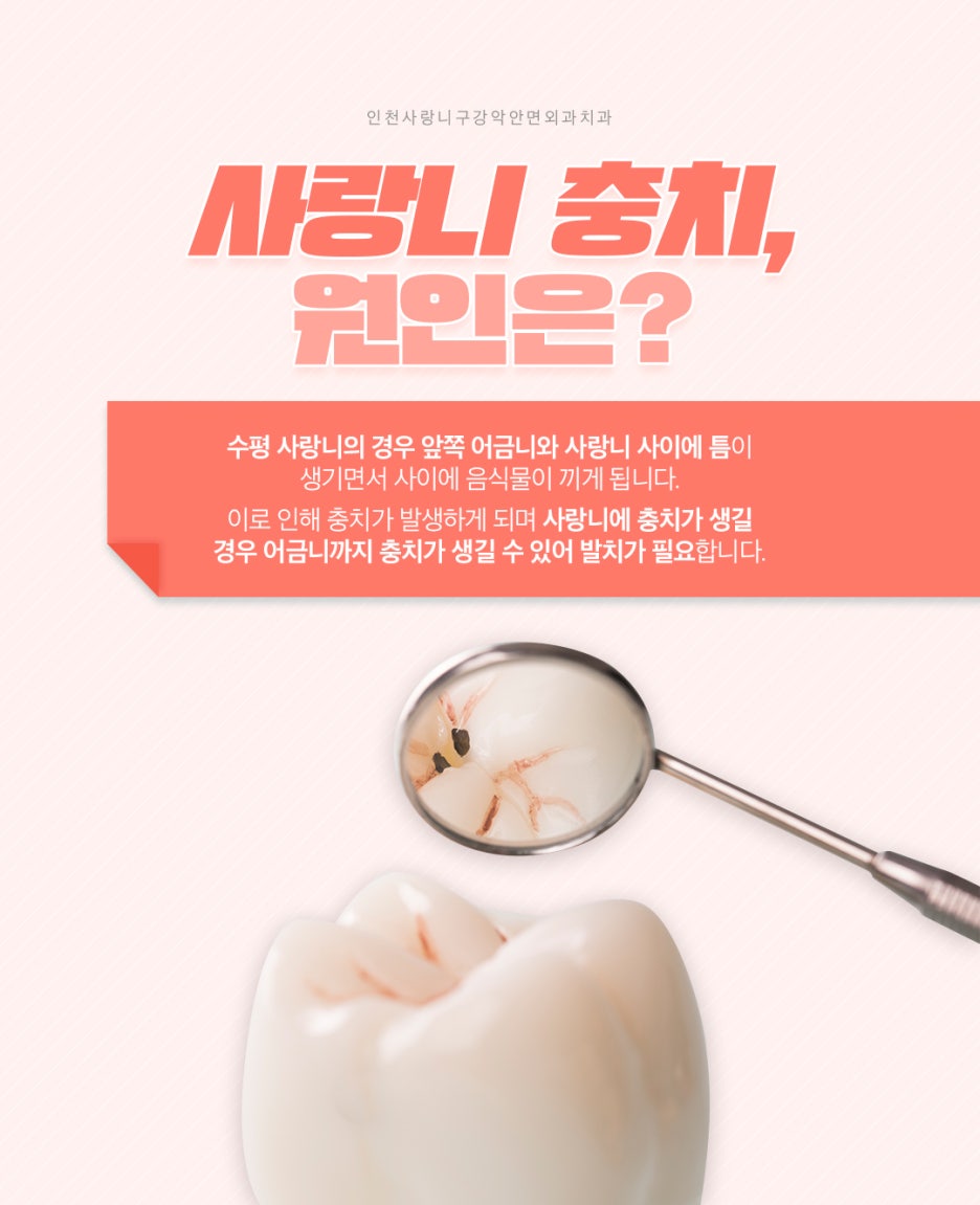 인천사랑니구강악안면외과치과의원 이미지