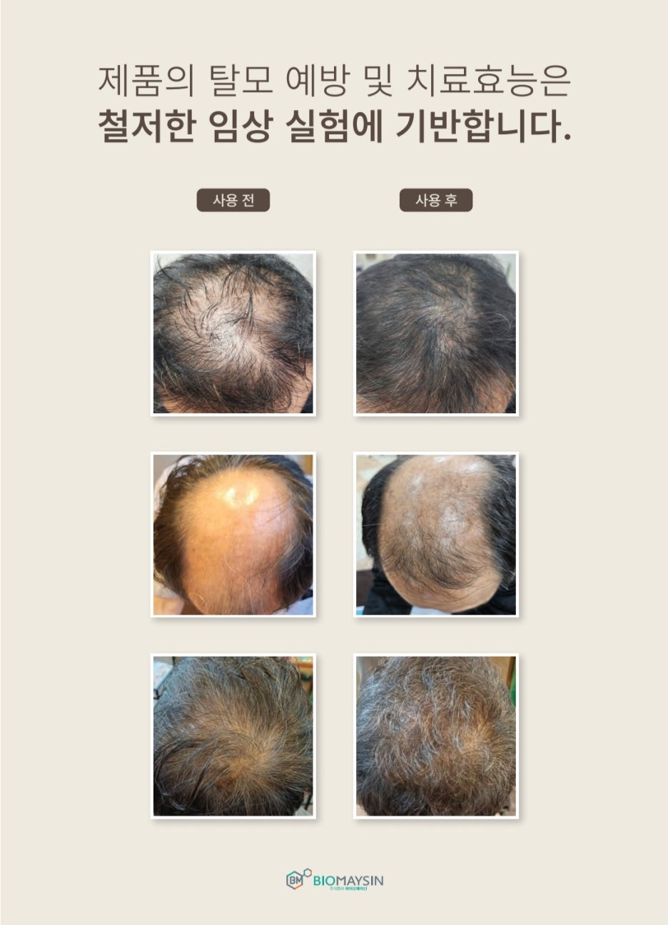 초록헤어 이미지