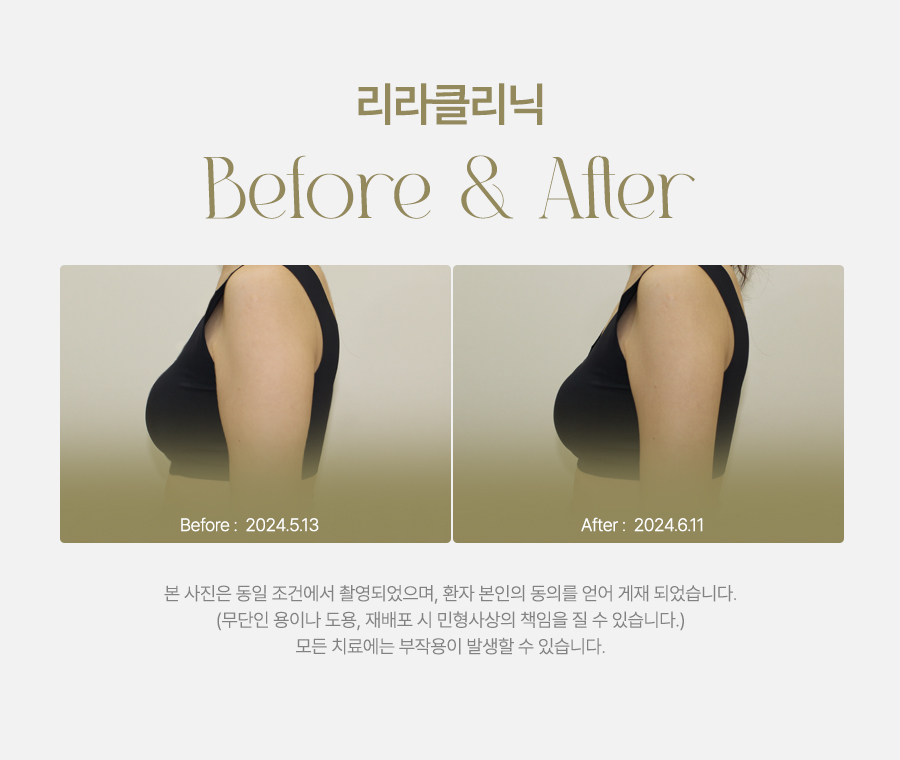 리라피부과의원 이미지