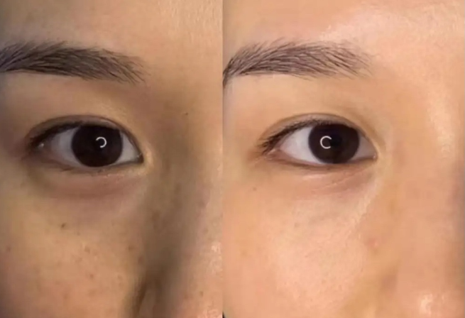 알디엠 이미지