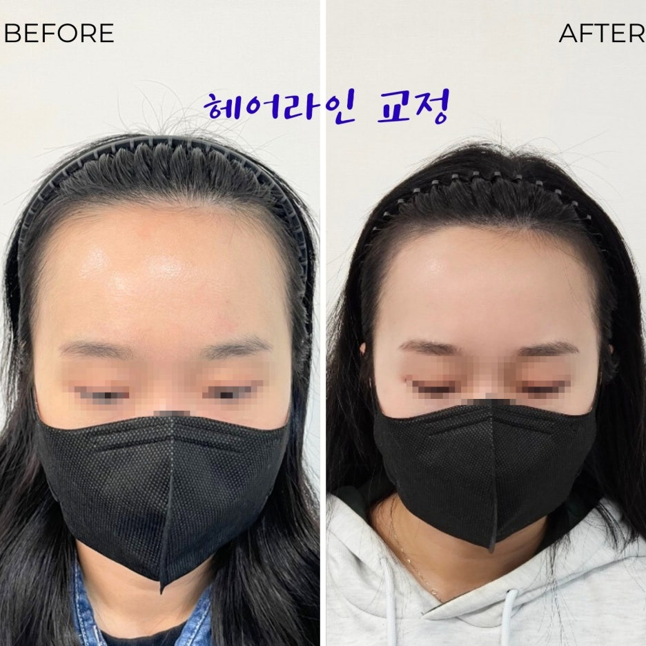 동안라인 이미지