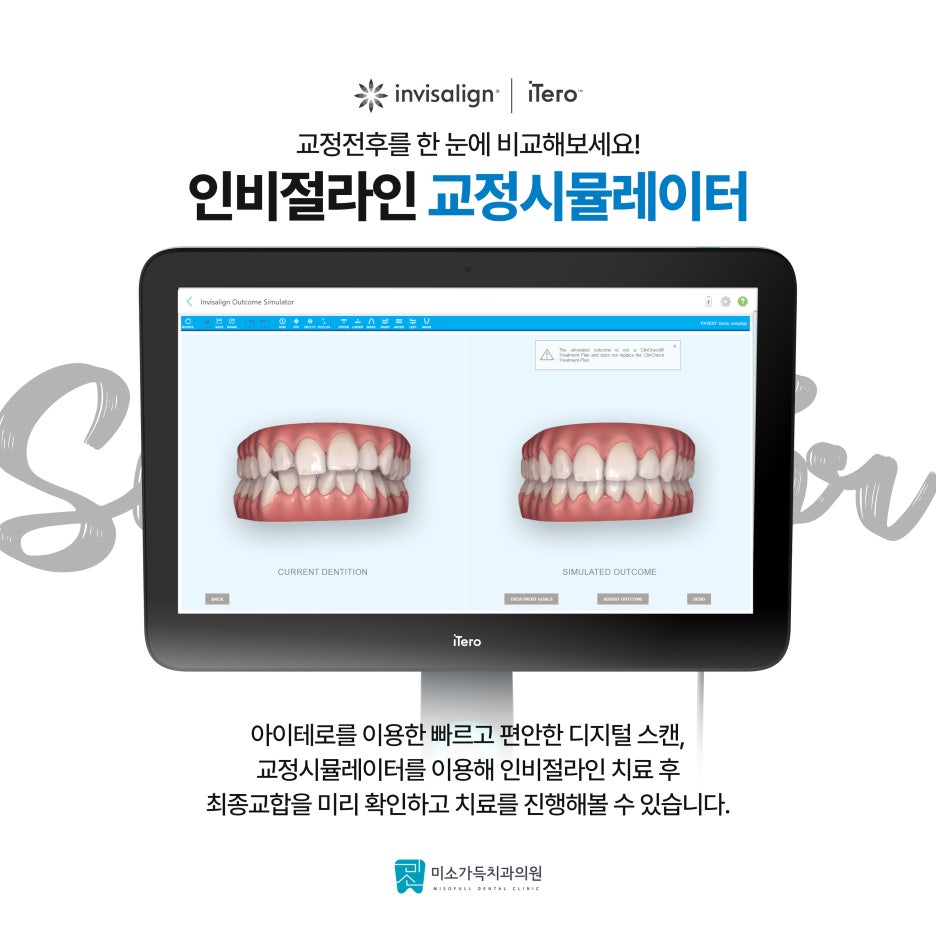 미소가득치과 이미지