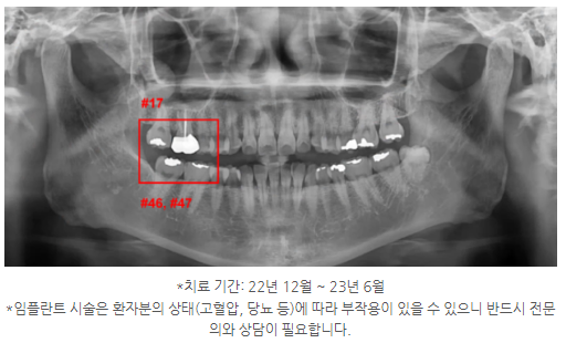 이천치과 이미지