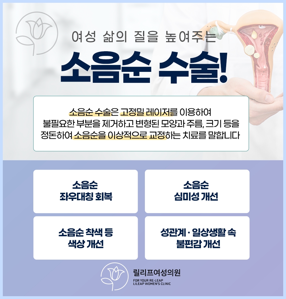 릴리프여성의원 이미지